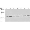 Anti-PMP22 antibody