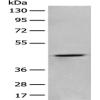 Anti-ADRA2A antibody