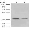 Anti-MBD2 antibody