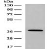 Anti-HOXA10 antibody