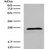Anti-DGCR6 antibody
