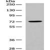 Anti-DLL1 antibody