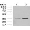 Anti-SLC25A27 antibody