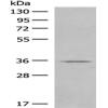 Anti-GPR119 antibody