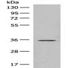 Anti-GPR146 antibody