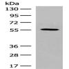 Anti-GPR22 antibody