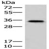 Anti-MS4A1 antibody