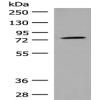 Anti-GPR149 antibody
