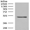 Anti-GPR152 antibody