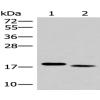 Anti-IL36A antibody