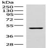 Anti-IP6K2 antibody
