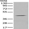 Anti-CHRNA5 antibody