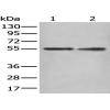 Anti-HSD17B10 antibody