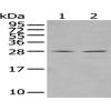 Anti-CXCL16 antibody