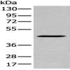 Anti-SERPINB7 antibody