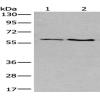 Anti-SLC17A8 antibody