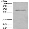 Anti-DSCC1 antibody