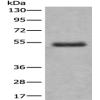 Anti-BTBD6 antibody