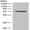 Anti-KLHL36 antibody