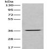Anti-LDAH antibody