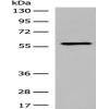 Anti-M1AP antibody