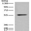 Anti-CORO1A antibody