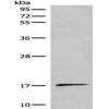 Anti-UCN3 antibody