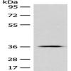 Anti-GPR55 antibody