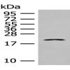Anti-IL23A antibody
