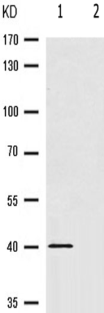 兔抗ADRB2(Phospho-Ser346)多克隆抗体 