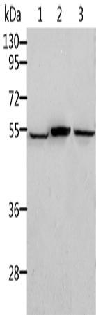 兔抗ALDH3B1多克隆抗体