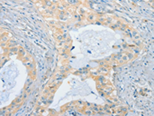兔抗CHRNA2多克隆抗体   