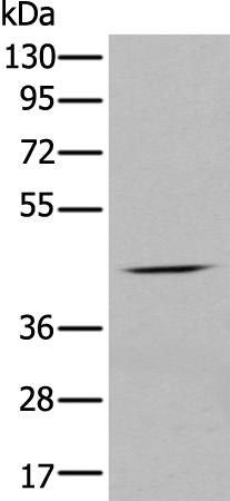 兔抗CHRNA5多克隆抗体 