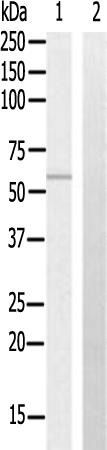 兔抗CHRNB1多克隆抗体  