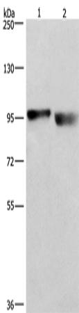 兔抗CIP2A多克隆抗体 