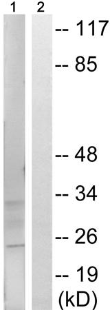 兔抗CLDN6(Phospho-Tyr219)多克隆抗体