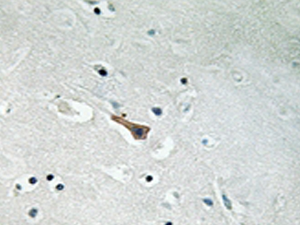 兔抗APLP2(Phospho-Tyr755) 多克隆抗体