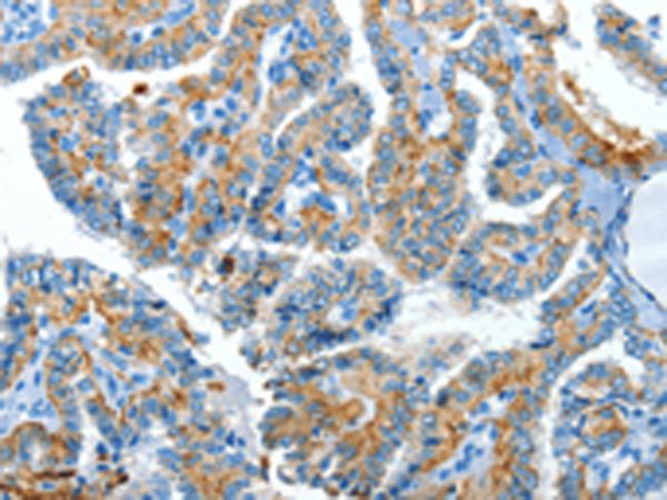 兔抗CLPTM1L多克隆抗体
