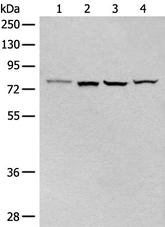 兔抗CLPTM1多克隆抗体   