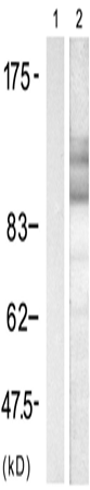 兔抗APP(Phospho-668)多克隆抗体