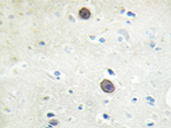 兔抗APP(Phospho-Thr743/668)多克隆抗体