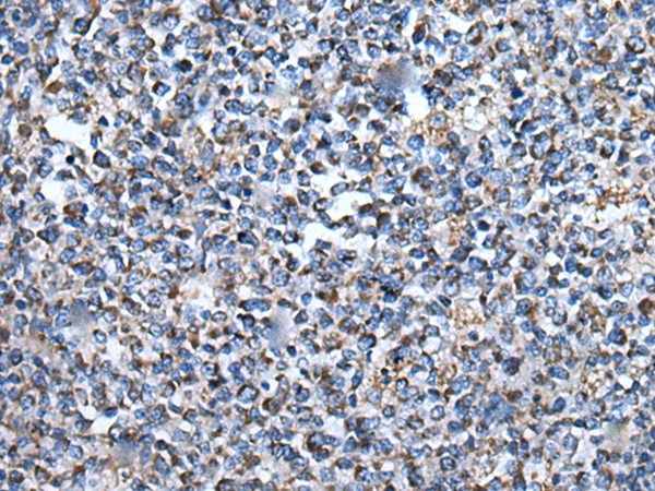 兔抗ARFGEF1多克隆抗体