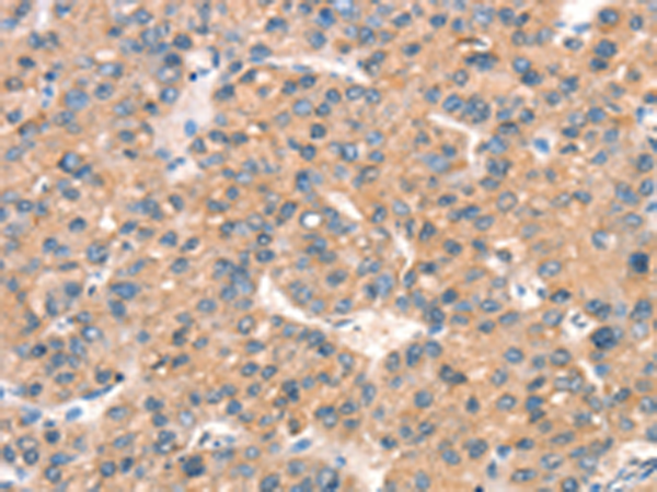 兔抗ARHGAP4多克隆抗体