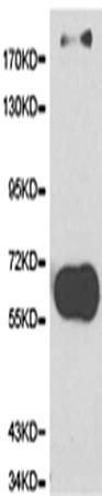 兔抗COL5A1多克隆抗体  