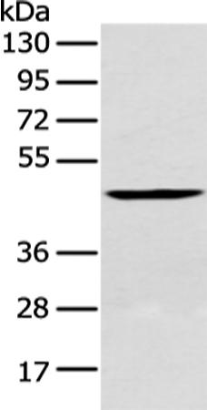 兔抗CRLF2多克隆抗体