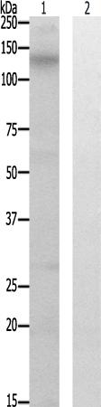 兔抗CSF1R(Phospho-Tyr561)多克隆抗体