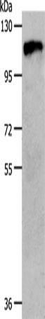 兔抗CSF1R多克隆抗体