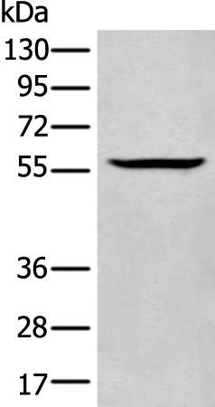 兔抗CSF1多克隆抗体 