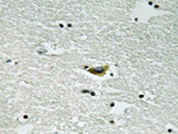 兔抗CSNK1A1(Phospho-Tyr294)多克隆抗体