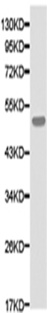 兔抗ATXN3多克隆抗体